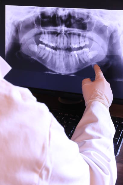 Best Emergency Tooth Extraction in Gilbert, IA